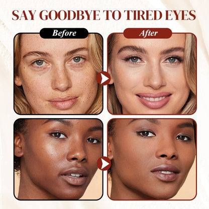 ✨ 50% OFF | Colour-Correcting Under-Eye Concealer – 4 Shades + Free Brush