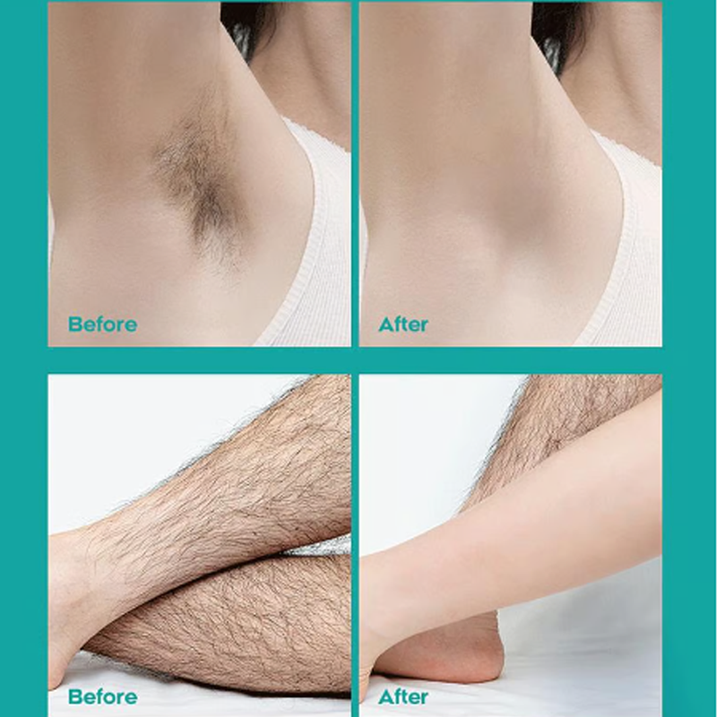 🔥Painless Full Body Hair Removal Cream for Men & Women– Skin-friendly for all areas🌿