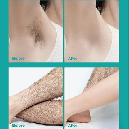 🔥Painless Full Body Hair Removal Cream for Men & Women– Skin-friendly for all areas🌿