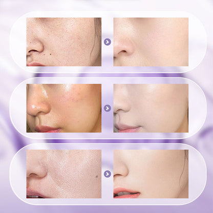 All-in-One Niacinamide Cream