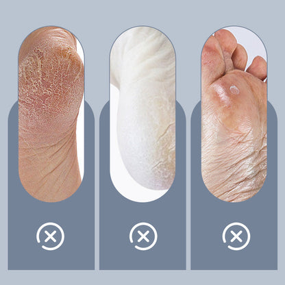 Household Adjustable Electric Foot Callus Remover