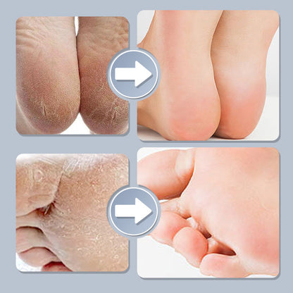 Household Adjustable Electric Foot Callus Remover