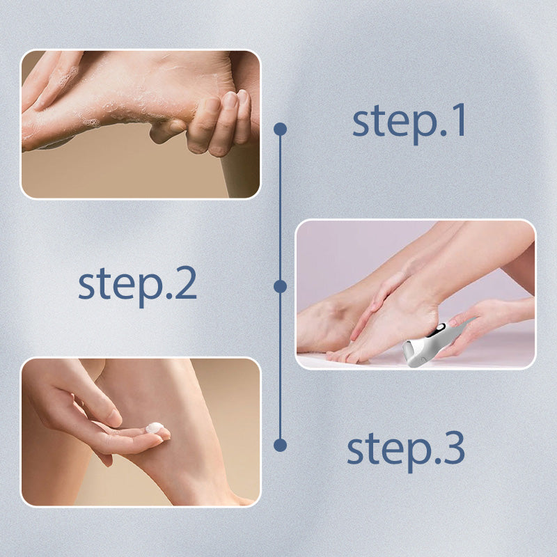 Household Adjustable Electric Foot Callus Remover