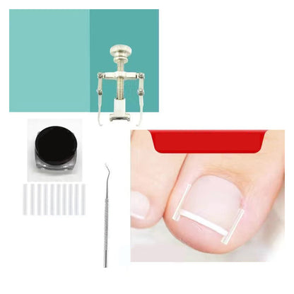 Ingrown Toenail Treatment Corrector Set