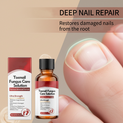 🖤See Real Results Faster🖤2 bottles Nail Repair Essence for Damaged Nails💅🏻