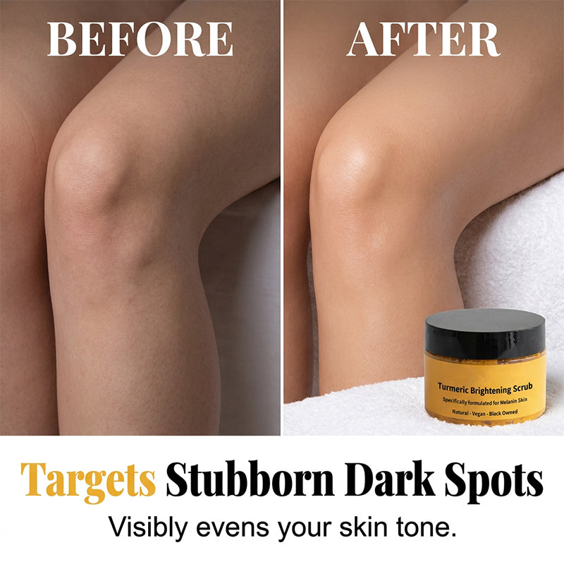 Brightening Turmeric Body Scrub – Gentle Exfoliation, Radiant Glow
