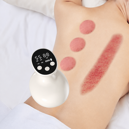 📢📢50% OFF !! ⏰Heated Vacuum Cupping Massager