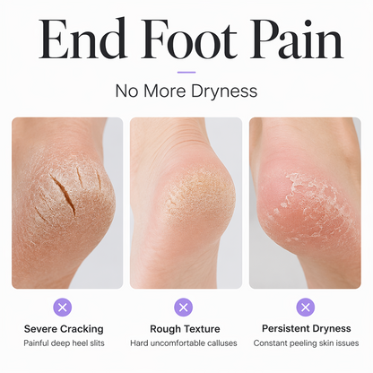 🩷BUY 1 GET 1 FREE🩷Moisturizing Foot Mask Exfoliating Silicone Socks Beach Protective Socks👣